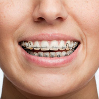 ortodontiaeortopedia